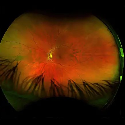 71WMHbsbBkL._AC_UY436_FMwebp_QL65_